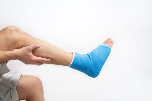 فیزیوتراپی شکستگی مچ پا در منزل
